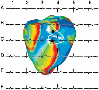 Reprinted with permission from Chaos 17(1), March 2007. Copyright 2007, American Institute of Physics.